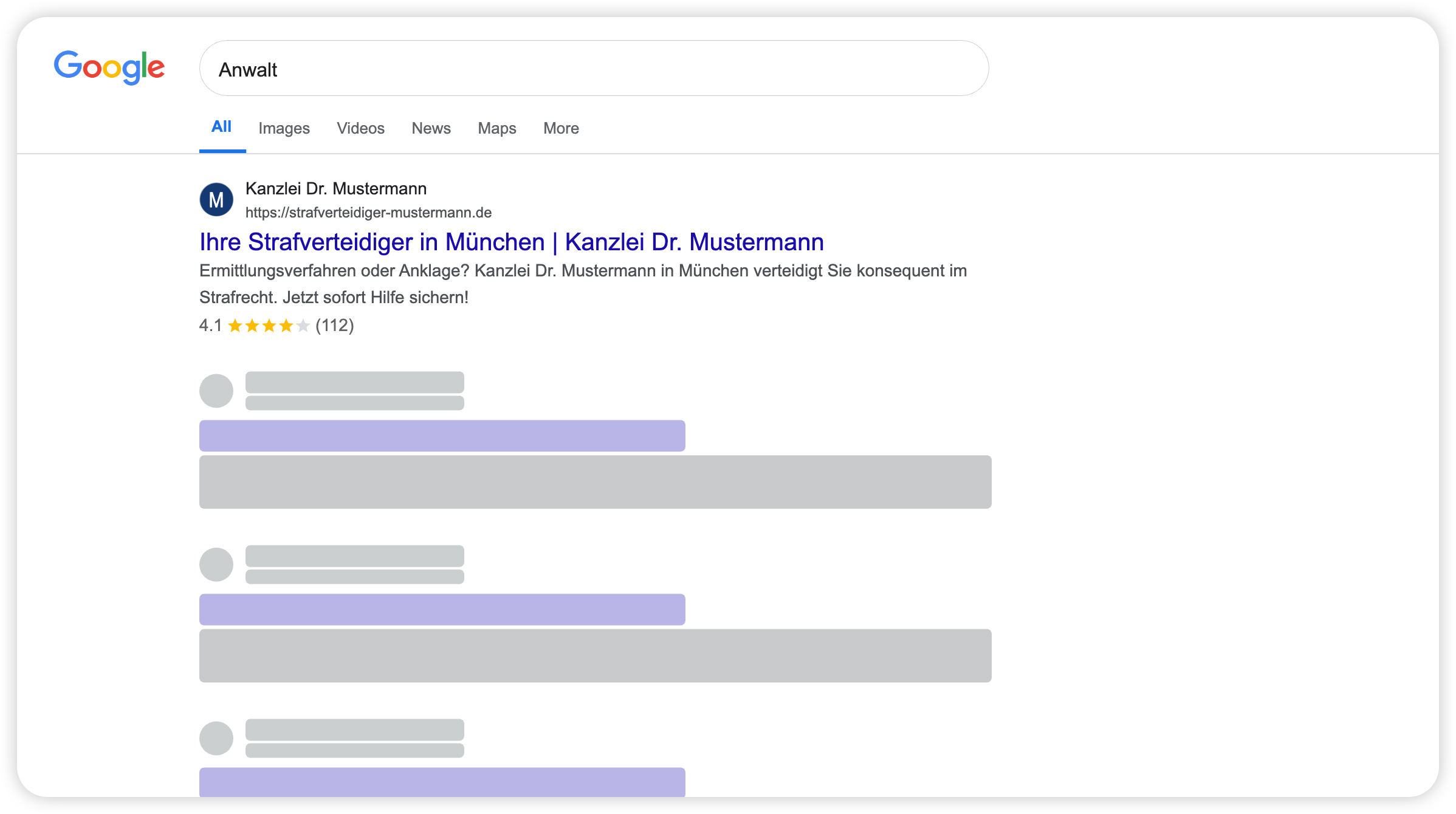 local-seo-fuer-notare-anwaelte-serp-beispiel SERP-Beispiel: So erscheint eine Kanzlei in den Google-Suchergebnissen. Local SEO für Notare und Anwälte steigert Sichtbarkeit, Klickrate und Mandantenanfragen.